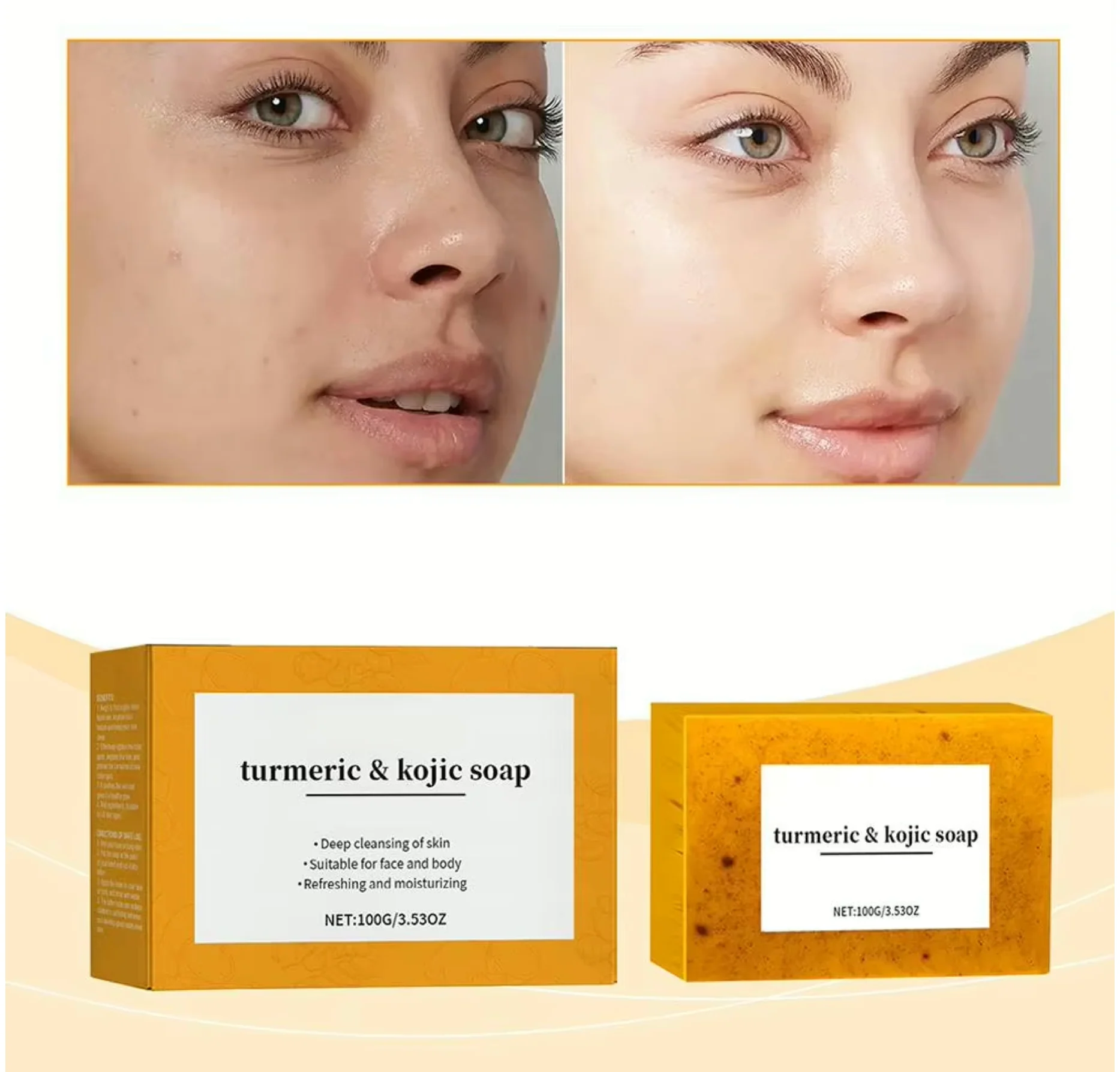 Turmeric and Kojic Soap Bar 100g - Image 2